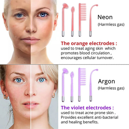 Luxurise High Frequency Skin Care Tool