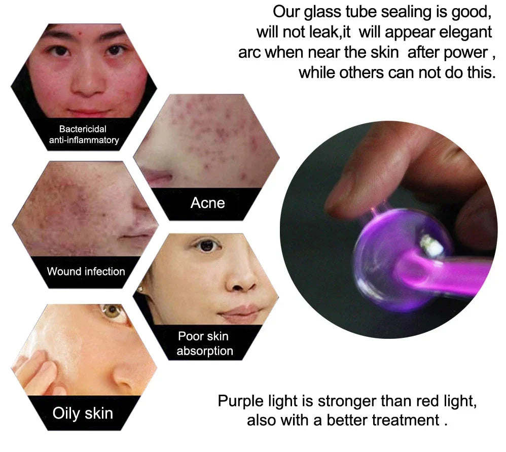 Luxurise High Frequency Skin Care Tool