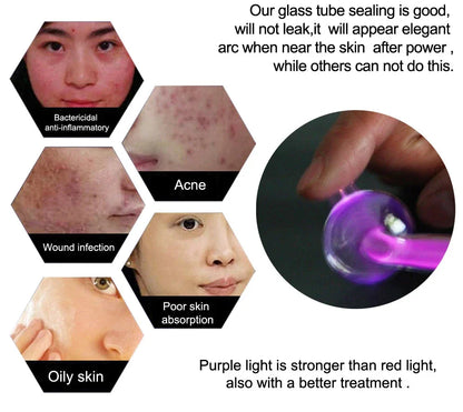 Luxurise High Frequency Skin Care Tool